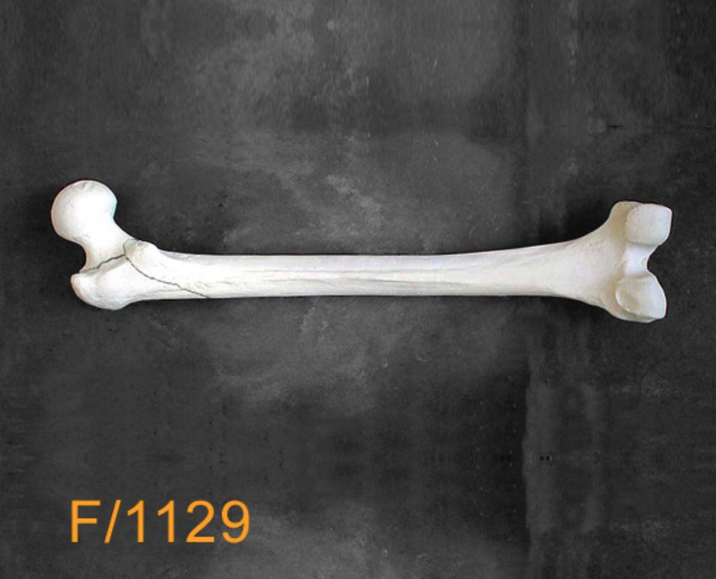 Femur Large Left 3 Part reverse troch fracture F1129