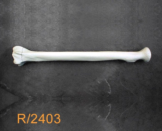 Radius Large Left with 3 part fracture R2403