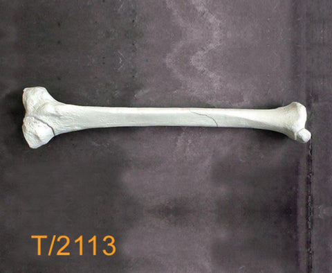 Tibia Large Left with multipe fractures T2113