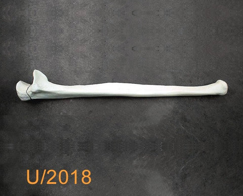 Ulna Large Left with transverse fracture U2018
