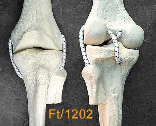 Knee Medium Left with 4 stretch cord ligaments
