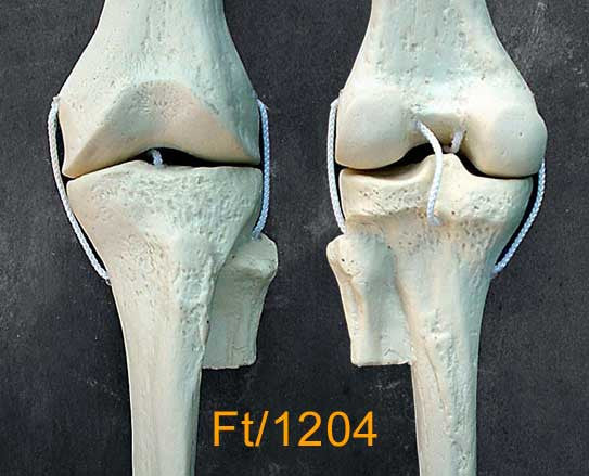 Knee Medium Left with 4 nylo cord ligaments. FT1204
