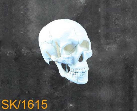 Full Skull - With nasal orbital and zygomatic fracture. SK1615