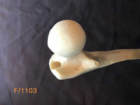 Femur Large Left. Reamed for intremedullary nail.F/1103