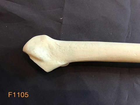 Femur Large Left.  Neck removed and broached for hip replacement.F/1105