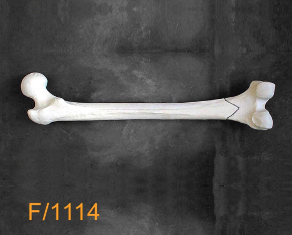 Femur Large Left. supracondylar distal fracture F1114