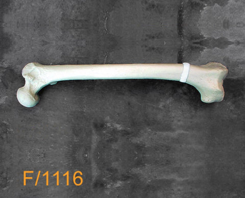 Femur Large Left. Distal valgus malunion F1116