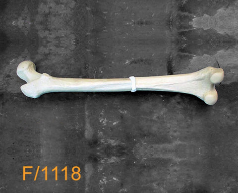 Femur Medium Left. midshaft malunion F1118