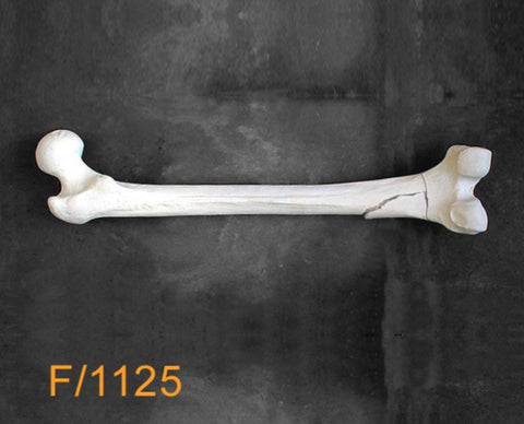 Femur Large Left Subrochantreric fracture F1125