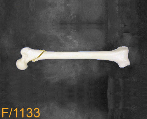 Femur Large Left spiral fracture F1133