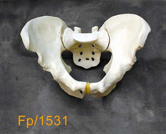 Full Pelvis - Large with posterior fracture FP1533