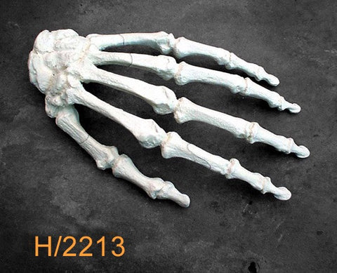 Hand Large Left with multible fractures H2213