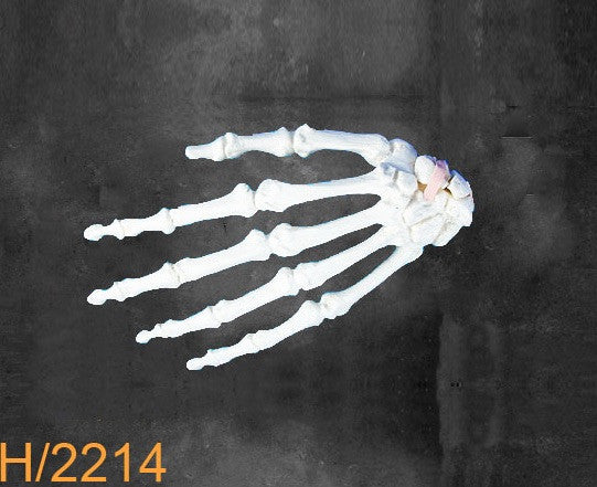 Hand Large Left transverse fracture H2214