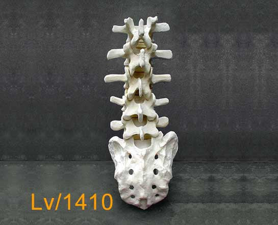 Lumbar Vertebrae and Sacrum. LV1410