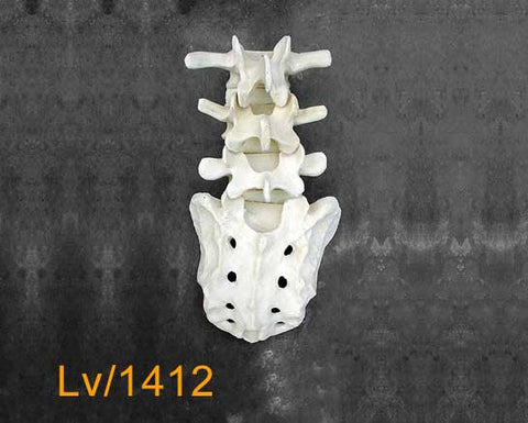 Lumbar Vertebrae L3 to Sacrum. LV1412
