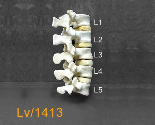 Lumbar Vertebrae.( Individual) LV1413