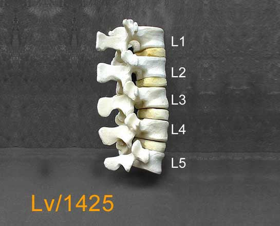 Lumbar Vertebrae without Sacrum. LV1425