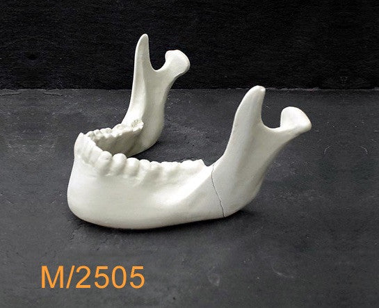 Mandible – With pre-angular mandibular fracture M2505