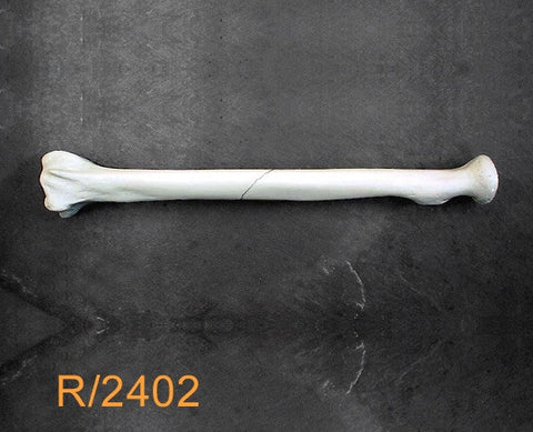 Radius Large Left with oblique mid-shaft fracture R2402
