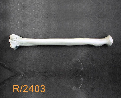 Radius Large Left with 3 part fracture R2403