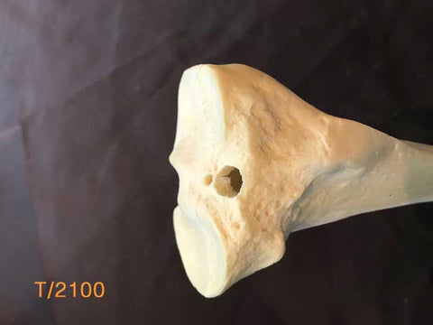 Tibia Large Left.  Reamed for intremedullary nail. T/2100