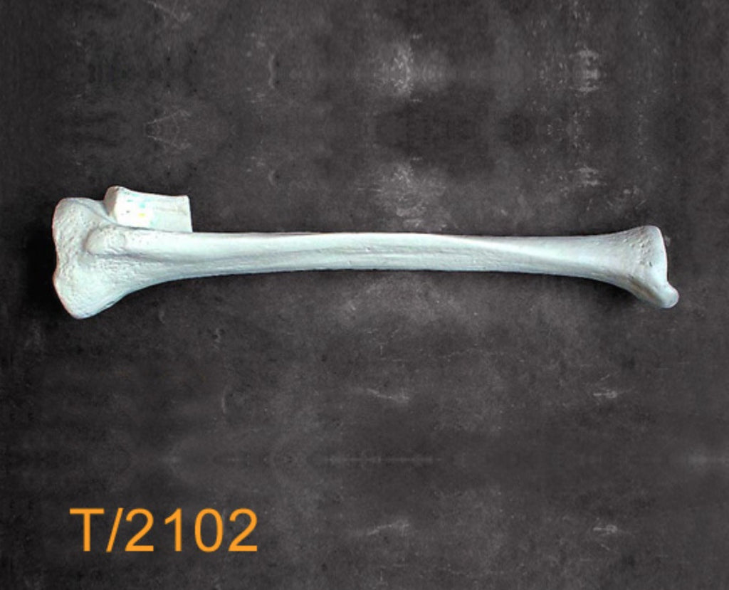 Tibia Medium Left with 12mm canal T2102