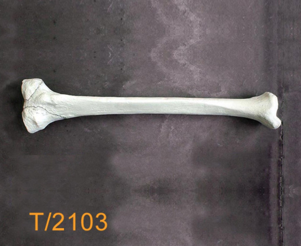 Tibia Large Left with plateau fracture T2103