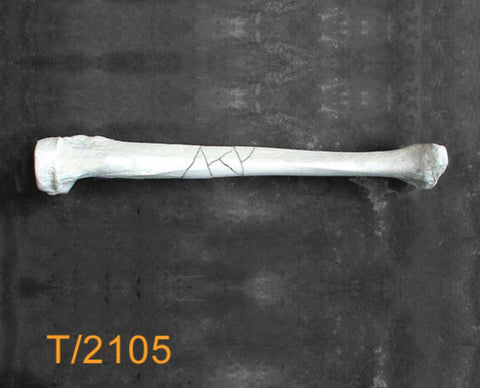 Tibia Large Left midshaft fracture T2105