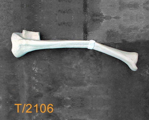 Tibia Large Left Varus deformity T2106