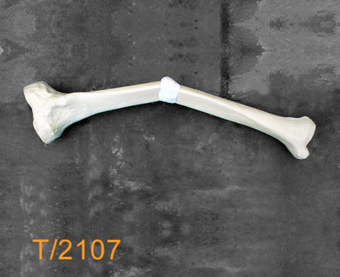 Tibia Large Left oblique varus deformity T2107