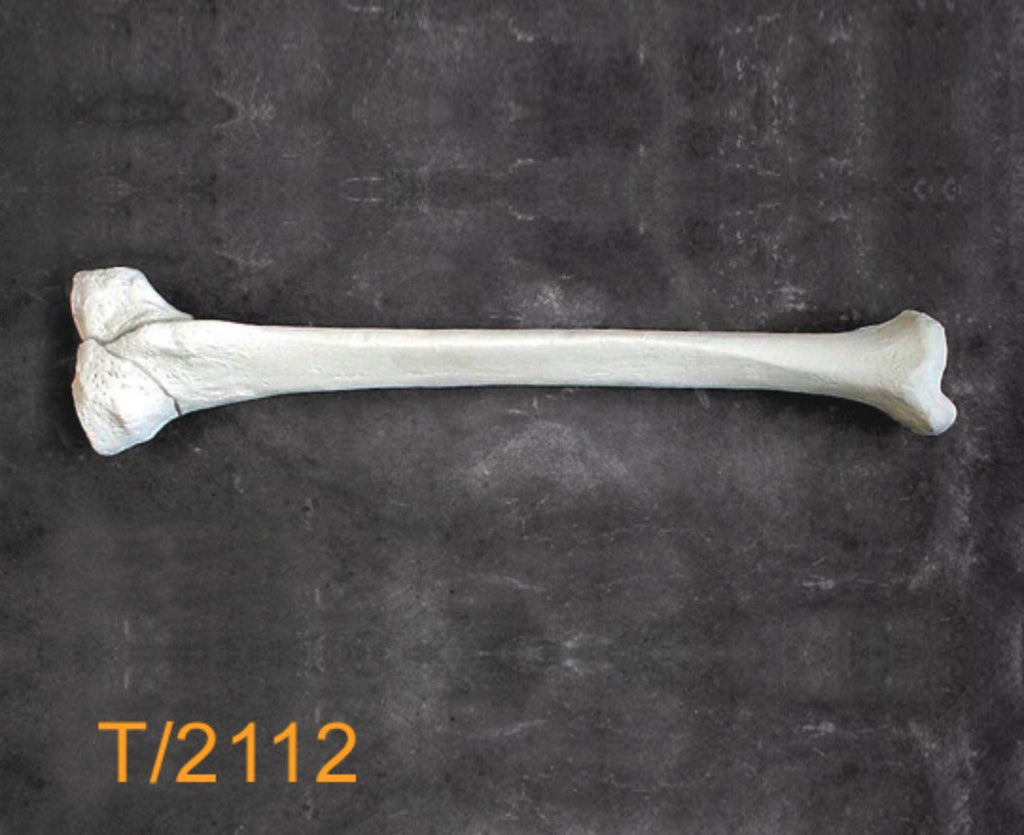 Tibia Large Left proximal Y fracture T2112