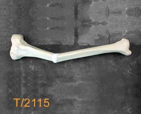 Tibia Large Left with proximal deformity T2115