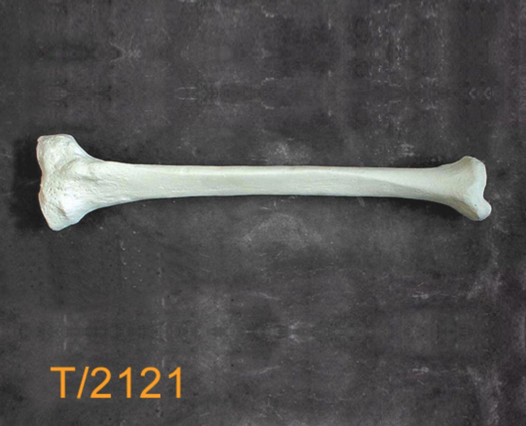Tibia Large Left with 12mm canal T2121