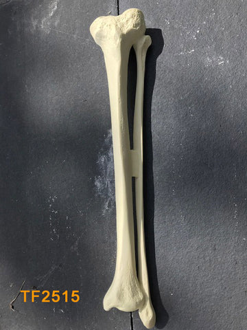 Tibia & Fibula Large Left canal 12mm TF2515