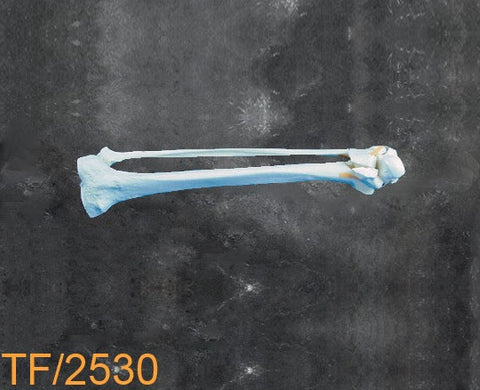 Ankle Large Left. with multible fractures TF2530