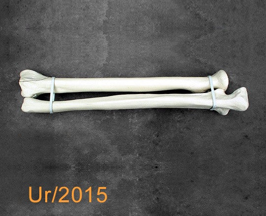 Ulna / Radius Large Left with radial fracture UR2015