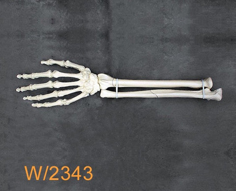 Wrist Large Left with multibe fractures W2343
