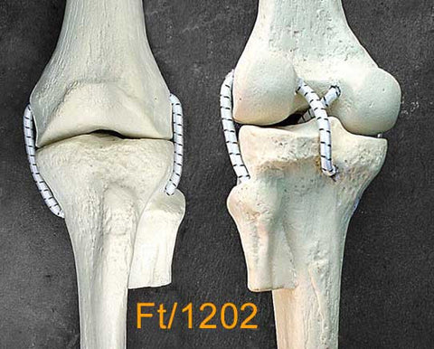 Knee Medium Left  with 4 stretch cord ligaments