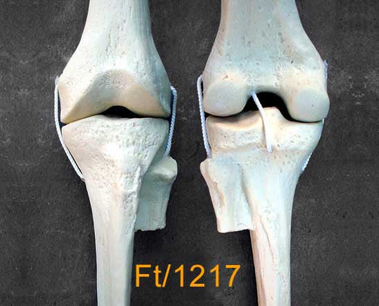 Knee Medium Left – with 3 nylon cord ligaments FT1217