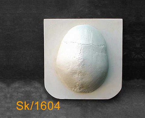 Skull Cap – Standard (no fractures) SK1604